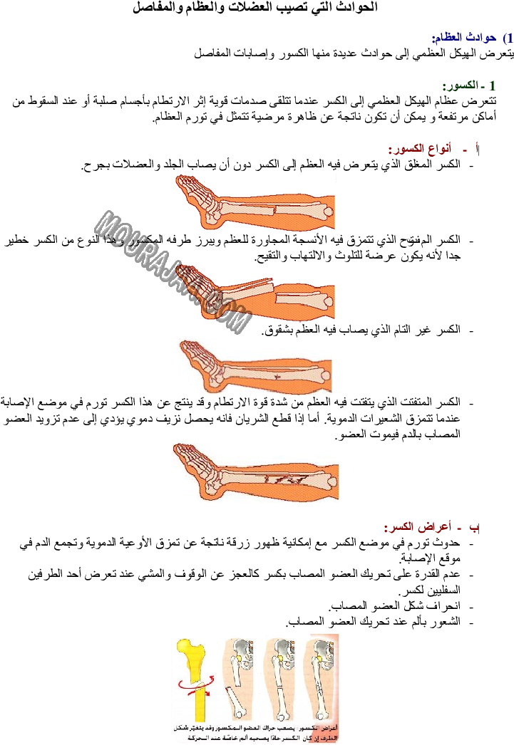 الحوادث التي تصيب العضلات والعظام والمفاصل